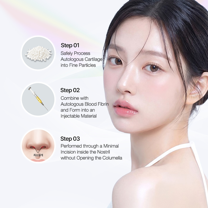 Cartilage-Particle Nose Injection (Closed)