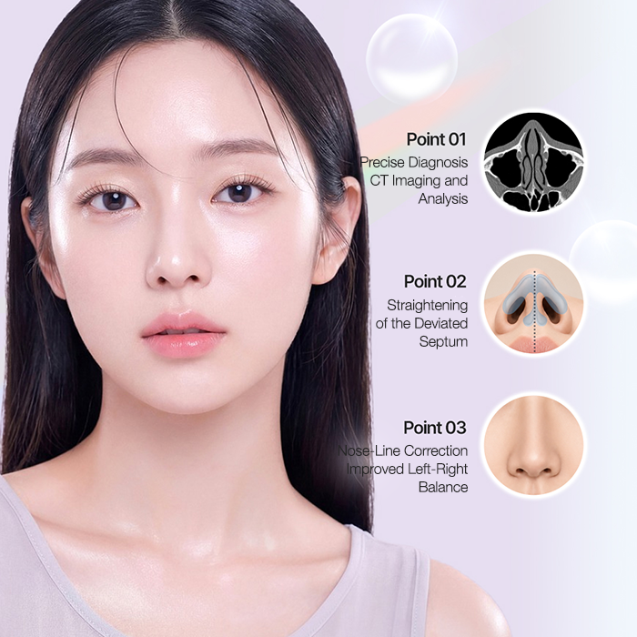 Crooked Nose Rhinoplasty