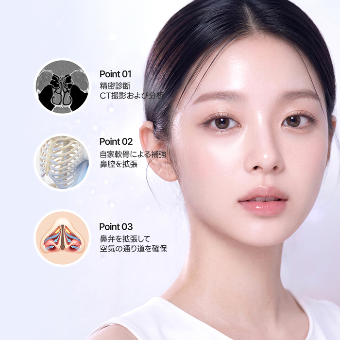 鼻弁狭窄症